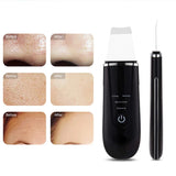 Wireless Ultrasonic Skin Scrubber Blackhead Remover Hot Compress Facial Cleansing Pore Cleanser Skin Spatula Peeling Face Care