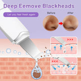 Ultrasonic Skin Scrubber Peeling Blackhead Remover Vibration Face Spatula Electric Scrubber Face Cleaning Facial Shovel Cleanser