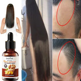 2024 Fast Hair Growth Serum Tonic for Men & Women Ginger Hair Growth Anti Fall Hair Loss Serum Thinning Treatment