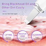 Ultrasonic Skin Scrubber Peeling Blackhead Remover Vibration Face Spatula Electric Scrubber Face Cleaning Facial Shovel Cleanser