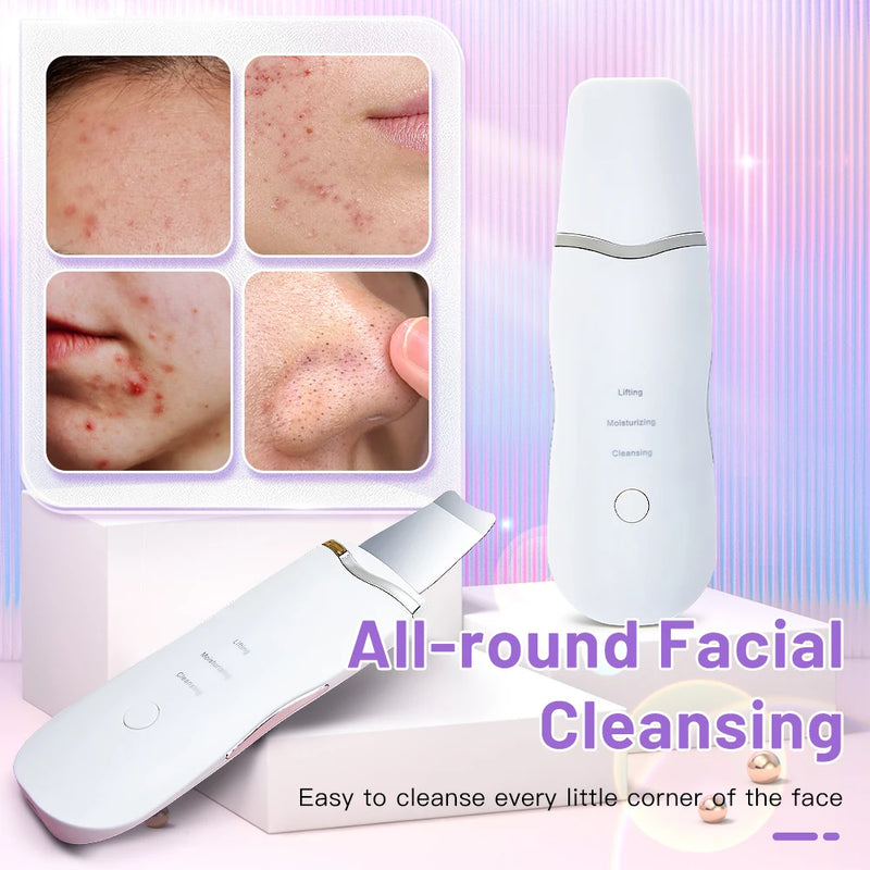 Ultrasonic Skin Scrubber Peeling Blackhead Remover Vibration Face Spatula Electric Scrubber Face Cleaning Facial Shovel Cleanser